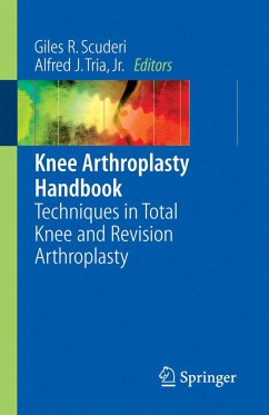 Knee Arthroplasty Handbook - Scuderi, Giles R. / Tria, Alfred J. Jr (eds.)