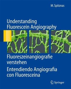 Understanding Fluorescein Angiography, Fluoreszeinangiografie verstehen, Entendiendo Angiografía con Fluoresceína - Spitznas, Manfred
