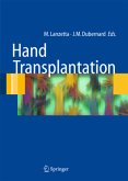 Hand transplantation