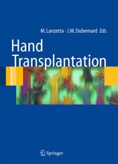 Hand transplantation - Lanzetta, Marco / Dubernard, Jean-Michel (eds.)