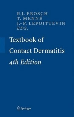 Contact Dermatitis Contact Dermatitis