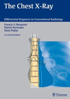 The Chest X-Rays - Burgener, Francis A.;Kormano, Martti;Pudas, Tomi