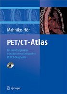 PET/CT-Atlas - Mohnike, W. / Hör, G.