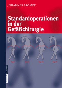 Standardoperationen in der Gefäßchirurgie - Frömke, Johannes