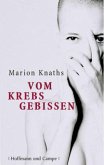 Vom Krebs gebissen