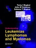 Understanding Leukemia, Lymphoma and Myeloma