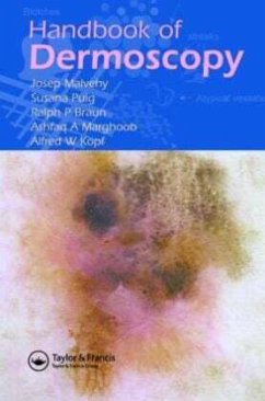 Handbook of Dermoscopy - Malvehy, Josep; Braun, Ralph P.; Puig, Susana