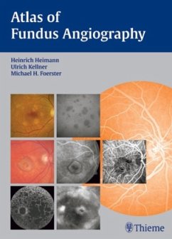 Atlas of Fundus Angiography - Heimann, / Kellner, / Foerster