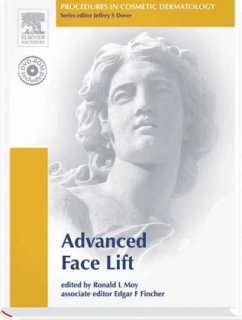 Advanced Face Lifting, w. DVD-ROM - Moy, Ronald L.; Fincher, Edgard F.