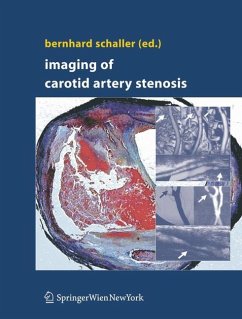 Imaging of Carotid Artery Stenosis - Schaller, Bernhard (ed.)