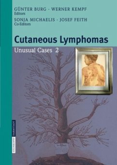 Cutaneous Lymphomas - Burg, Günter / Kempf, Werner (eds.)