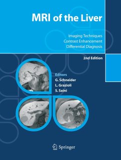 MRI of the Liver - Schneider, Günther / Grazioli, Luigi / Saini, Sanjay (eds.)