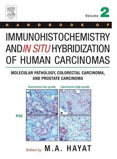 Handbook of Immunohistochemistry and in Situ Hybridization of Human Carcinomas - Handbook of Immunohistochemistry and in Situ Hybridization of Human Carcinomas