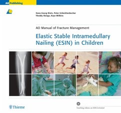 Elastic Stable Intramedullary Nailing (ESIN) in Children - Dietz, Hans-Georg