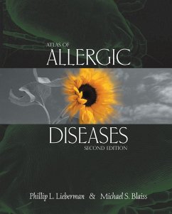 Atlas of Allergic Diseases - Lieberman, Phillip L. / Blaiss, Michael S. (eds.)