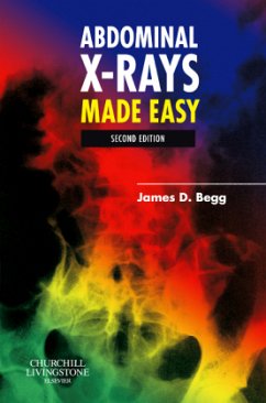 Abdominal X-Rays Made Easy - Begg, James D.