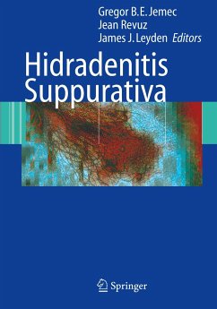 Hidradenitis Suppurativa - Jemec, Gregor B.E. / Revuz, Jean / Leyden, James J. (eds.)