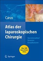 Atlas der laparoskopischen Chirurgie - Carus, Thomas
