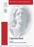 Liposuction, w. DVD-ROM