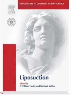 Liposuction, w. DVD-ROM - Hanke, C. W.; Sattler, Gerhard