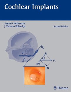 Cochlear Implants - Waltzman, Susan B. / Roland, Thomas