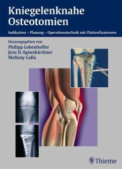 Kniegelenknahe Osteotomien - Lobenhoffer / Agneskirchner / Galla