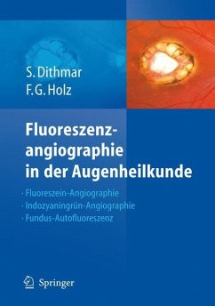 Fluoreszenzangiographie in der Augenheilkunde - Dithmar, Stefan;Holz, Frank G