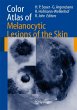 Color Atlas of Melanocytic Lesions of... - Bild 1