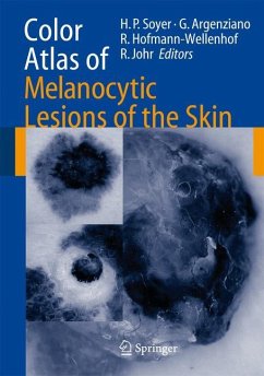 Color Atlas of Melanocytic Lesions of the Skin - Soyer, Hans Peter / Argenziano, Giuseppe / Hofmann-Wellenhof, Rainer / University of Miami (eds.)