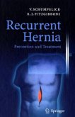 Recurrent Hernia