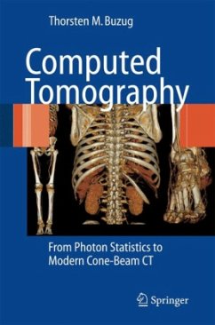 Computed Tomography - Buzug, Thorsten M.