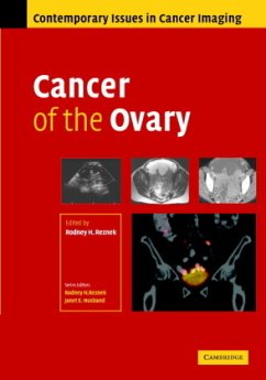 Cancer of the Ovary - Reznek, Rodney (ed.)