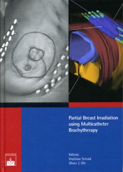 Cover Partial Breast Irradiation Using Multicatheter Brachytherapy