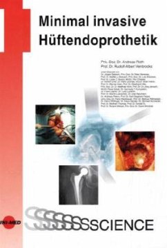 Minimal invasive Hüftendoprothetik - Roth, Andreas;Venbrocks, Rudolf-Albert