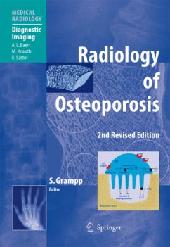 Radiology of Osteoporosis - Grampp, Stephan (Bearb.)