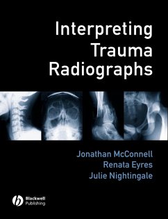 Interpreting Trauma Radiographs - Mcconnell, Jonathan / Eyres, Renata / Nightingale, Julie