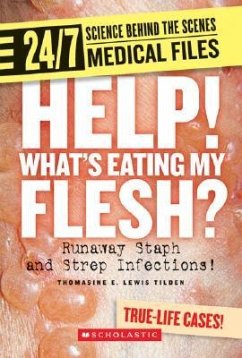 Help! Whats Eating My Flesh?: Runaway Staph and Strep Infections! - Tilden, Thomasine E. Lewis
