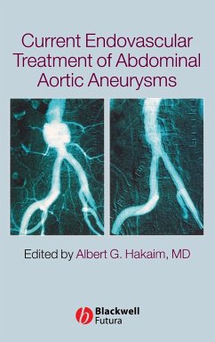 Current Endovascular Treatment of Abdominal Aortic Aneurysms - Hakaim, Albert (ed.)