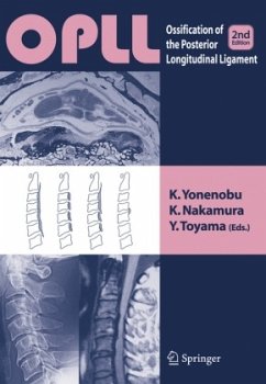 OPLL: Ossification of Posterior Longitudinal Ligament - Yonenobu, Kazuo / Nakamura, Kozo / Toyama, Yoshiaki (eds.)