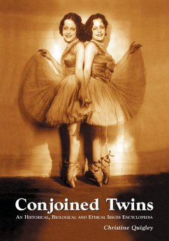 Conjoined Twins - Quigley, Christine