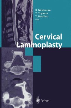 Cervical Laminoplasty - Nakamura, K. / Toyama, Y. / Hoshino, Y. (Hgg.)