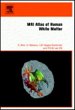 MRI Atlas of Human White Matter - Bild 1