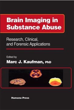 Brain Imaging in Substance Abuse - Kaufman, Marc J. (ed.)