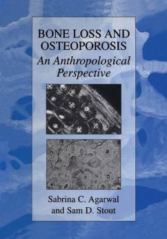 Bone Loss and Osteoporosis - Agarwal, Sabrina C. / Stout, Samuel D. (Hgg.)