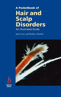 Pocketbook of Hair and Scalp Disorders