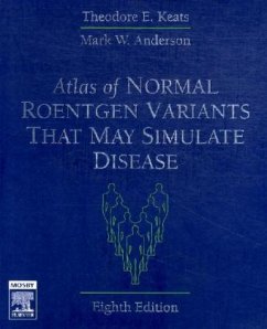 Atlas of Normal Roentgen Variants That May Simulate Disease - Keats, Theodore E.; Anderson, Mark W.