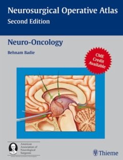 Neuro-Oncology - Badie, Behnam