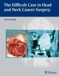 Cover The Difficult Case in Head and Neck Cancer Surgery