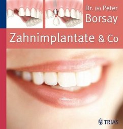 Zahnimplantate & Co. - Borsay, Peter