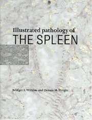 Illustrated Pathology of the Spleen - Wilkins, Bridget S; Wright, Dennis H